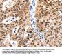LRP5 Antibody