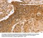 VIM Antibody