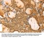 VIM Antibody