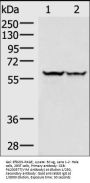 VIM Antibody