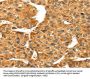 S100A14 Antibody