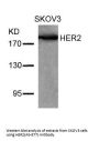 ERBB2 (Ab-877) Antibody