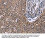 CSF2RB Antibody