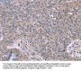 CSF2RB Antibody