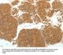 SIRT4 Antibody