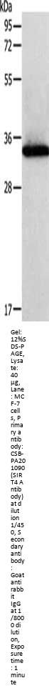 SIRT4 Antibody