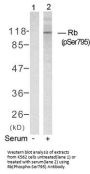 Phospho-RB1 (Ser795) Antibody