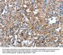 Rabbit anti-human PLA2G6 polyclonal antibody