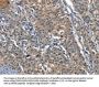 Rabbit anti-human PLA2G6 polyclonal antibody
