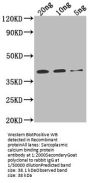 Sarcoplasmic calcium binding protein Antibody