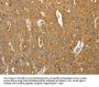 AKR1B1 Antibody