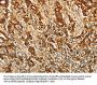 AKR1B1 Antibody