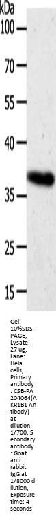 AKR1B1 Antibody