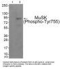 Phospho-MUSK (Tyr755) Antibody