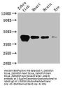 acta1b Antibody