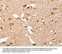 CAPG Antibody