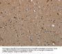 MYO7A Antibody