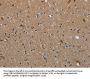 MYO7A Antibody