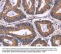 Rabbit anti-human KIR2DL3/KIR2DL1/KIR2DL4/KIR2DS4 polyclonal antibody