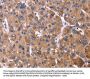 Rabbit anti-human KIR2DL3/KIR2DL1/KIR2DL4/KIR2DS4 polyclonal antibody