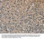 Rabbit anti-human ENO1 polyclonal antibody