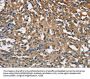 Rabbit anti-human ENO1 polyclonal antibody