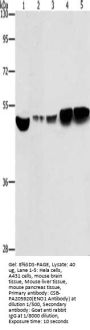 Rabbit anti-human ENO1 polyclonal antibody
