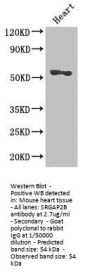 SRGAP2B Antibody