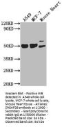 SRGAP2B Antibody