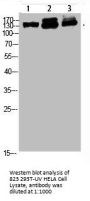 NFAT5 Antibody