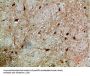 NFAT5 Antibody