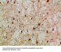 NFAT5 Antibody