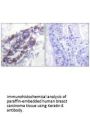 KRT8 Antibody