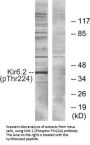 Phospho-KCNJ11 (Thr224) Antibody