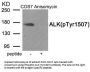 Phospho-ALK (Tyr1507) Antibody