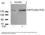 Phospho-EGFR (Ser1070) Antibody