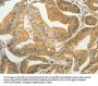 TAGLN2 Antibody