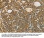 TAGLN2 Antibody