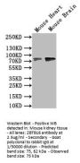 ZBTB16 Antibody