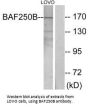 ARID1B Antibody