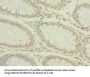 CPD Antibody