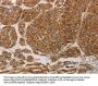 PRDX3 Antibody