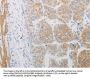 ADRB2 Antibody