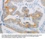 ADRB2 Antibody