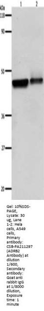 ADRB2 Antibody