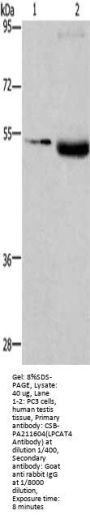LPCAT4 Antibody