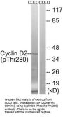 Phospho-CCND2 (Thr280) Antibody