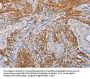 KLK4 Antibody