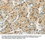 TRIB1 Antibody