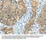 TRIB1 Antibody